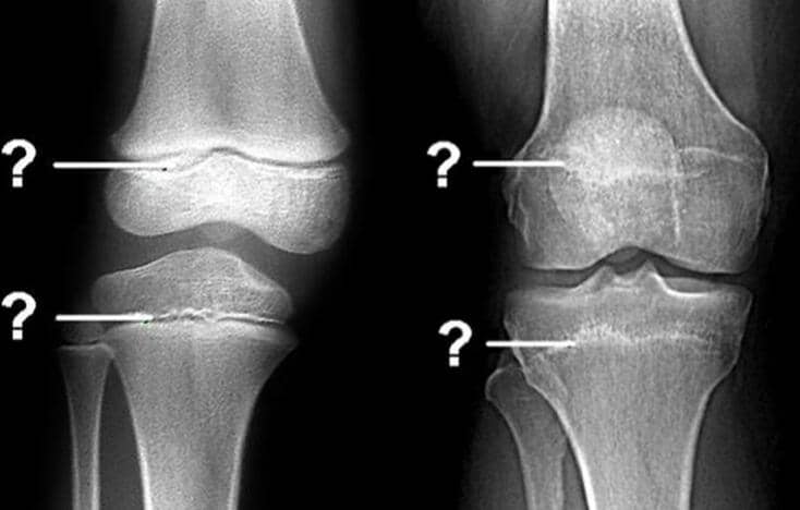 刘恒21天增高计划—科学增高，塑造挺拔体态